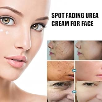 Spot Fading Urea Cream, Spot Fading cream,Urea Face Cream,Vtamin E Urea Cream,Reduce Dark Spots (3)