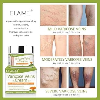 OTBK Varicose Vein Cream, Varicose Vein Relief Leg Cream, Relieves Phlebitis VeinsTreats Spider Veins in LegsImproves Leg Appearance